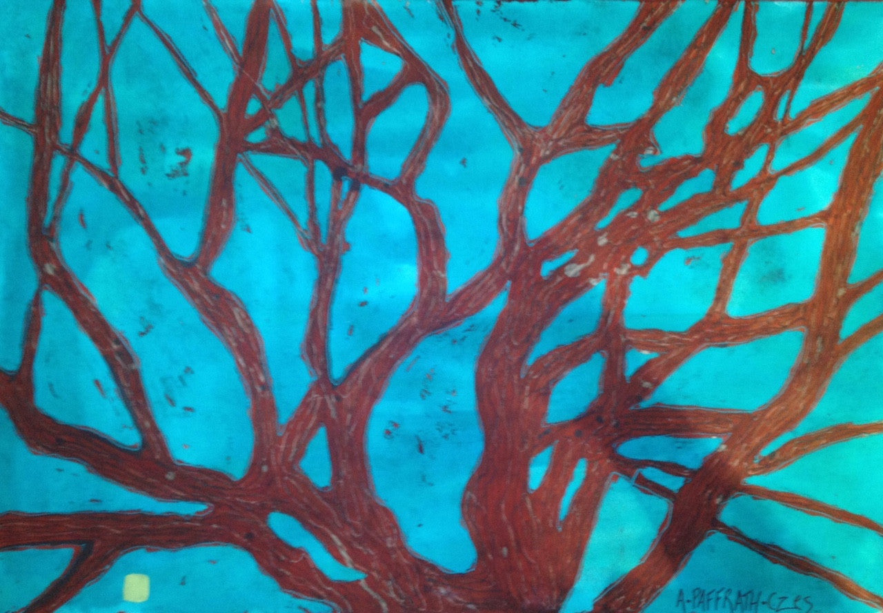 Reaching Roots - Art 4 All Hats & Artwork by Abby Paffrath